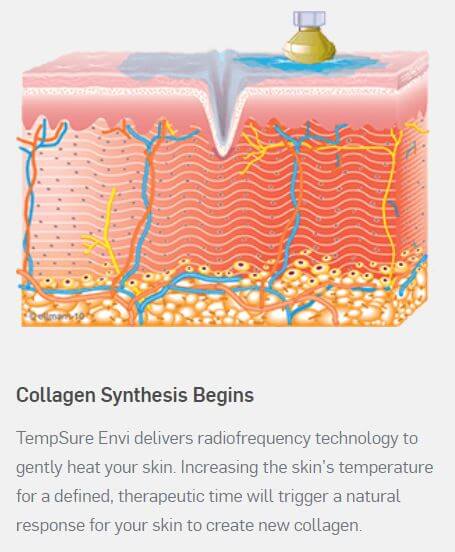 Capture2 tempsure envi how it works.jpg