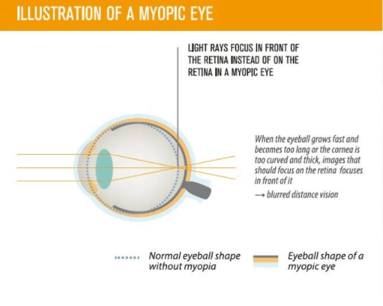 eye exams near me