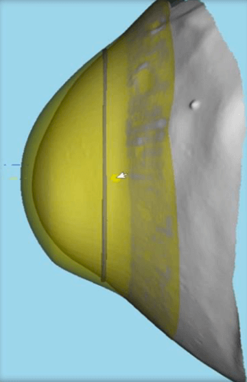 3d view