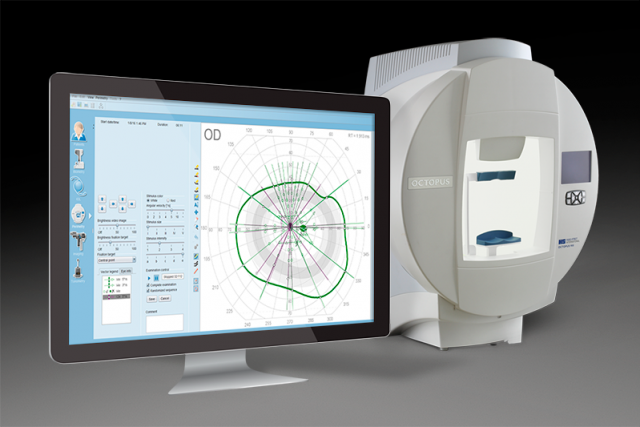 Semi automated kinetic Simplified display o900