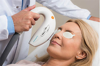Lumenis IPL Thumbnail.jpg