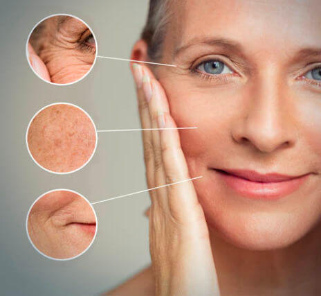 Square ups MedSpa2