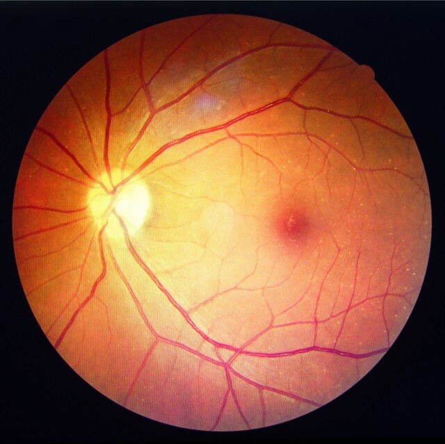 optical store near you