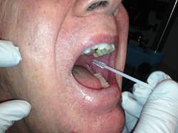 Macula Risk