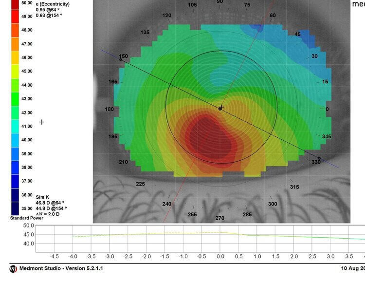 topography+image