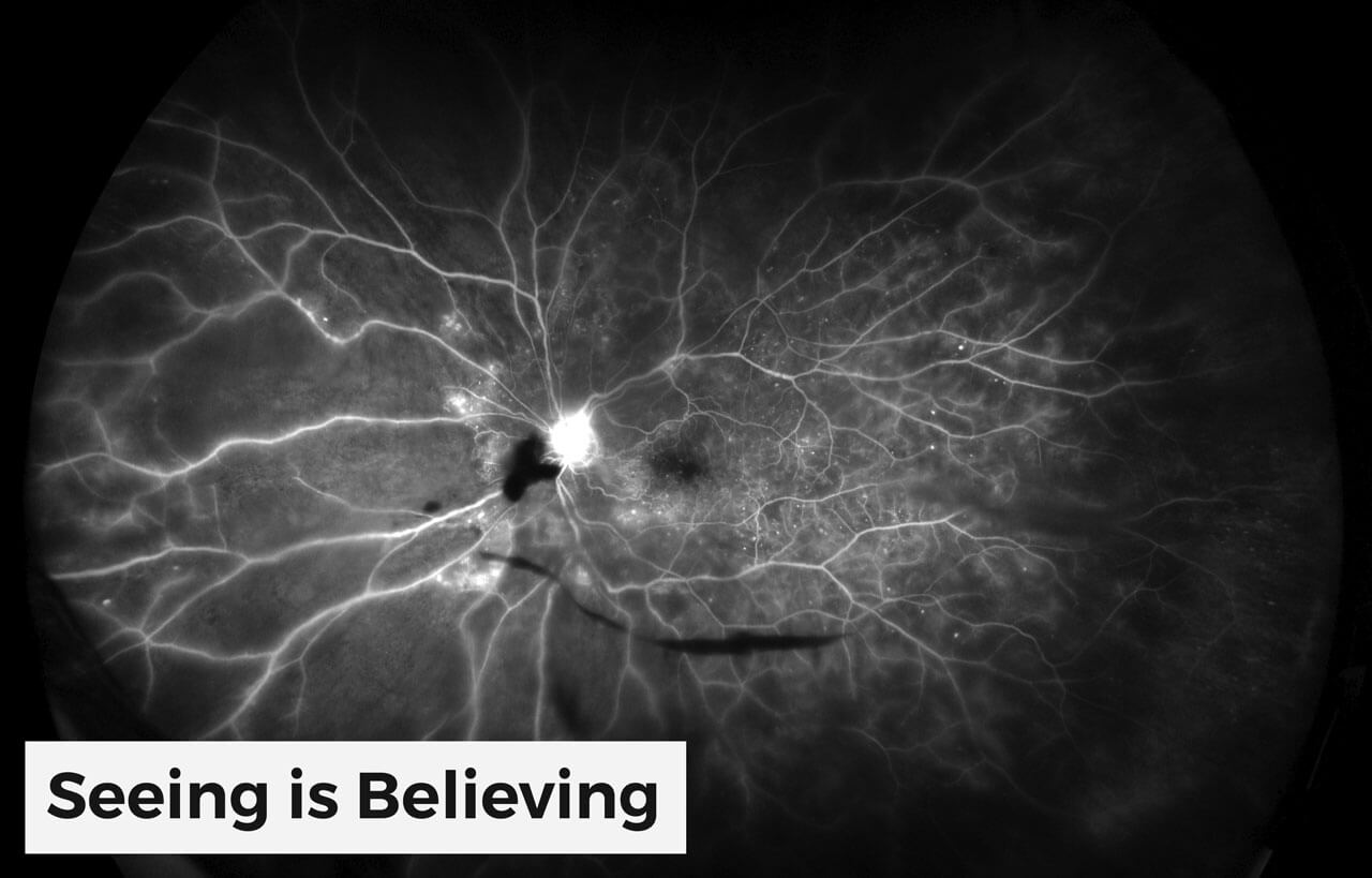 Diabetic Retinopathy Consultants v2