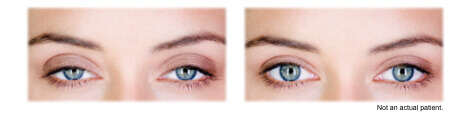 before and after