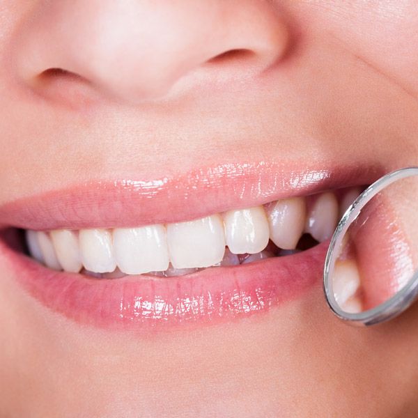 Healthy smile and a dental mirror