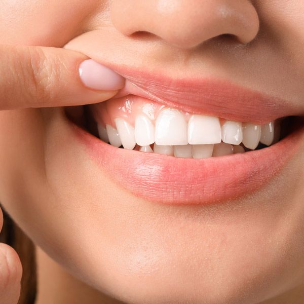 Woman lifting lip to show healthy gums