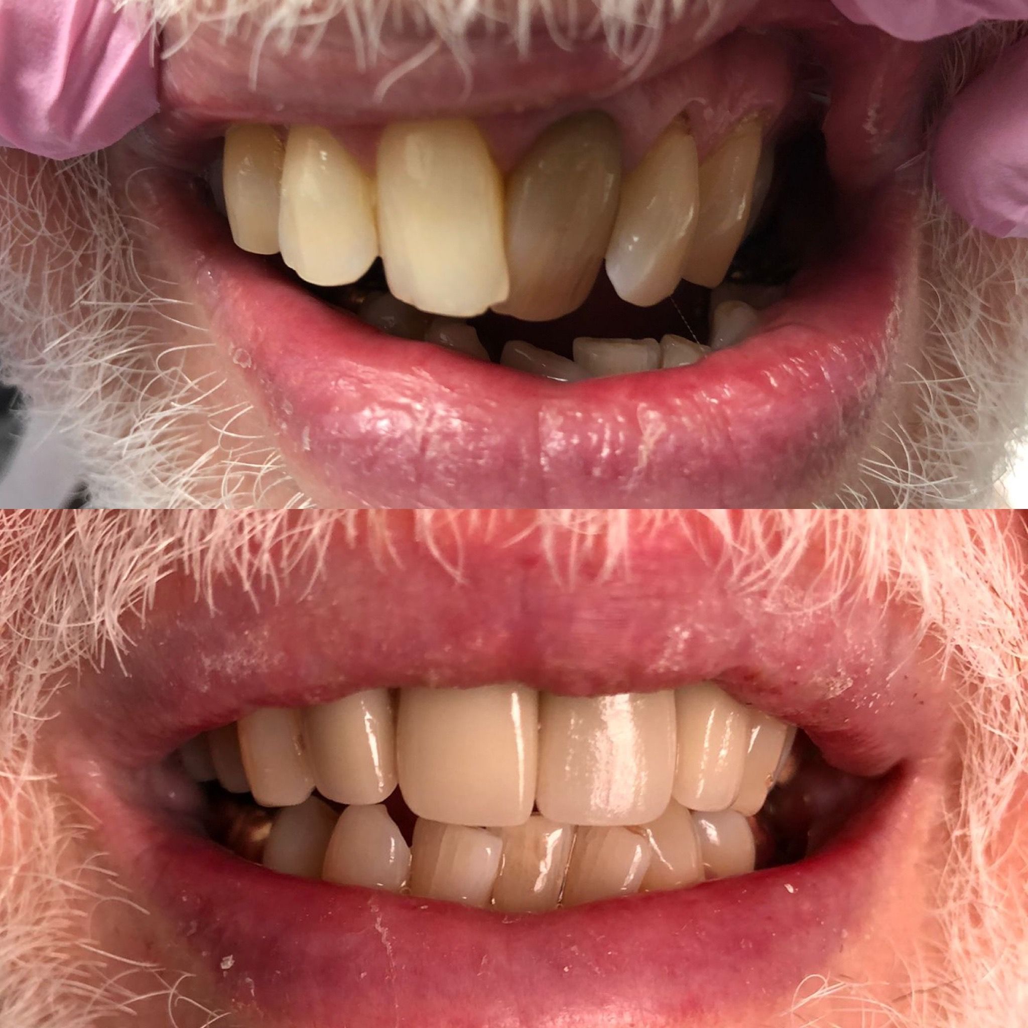 Before smile makeover