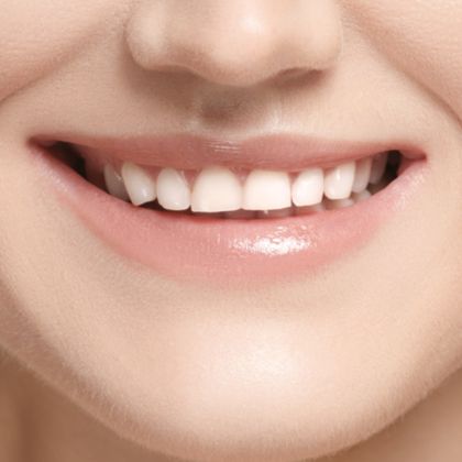 Small, misshaped teeth