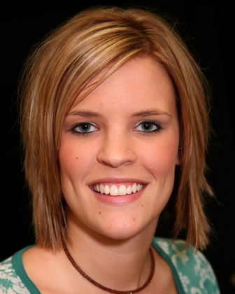 After veneer placement