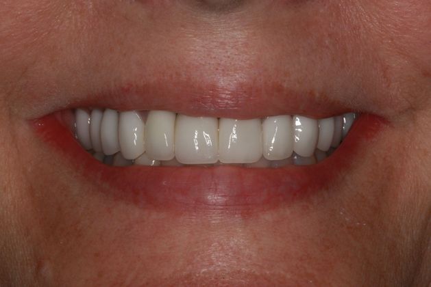 beautiful smile after treatment