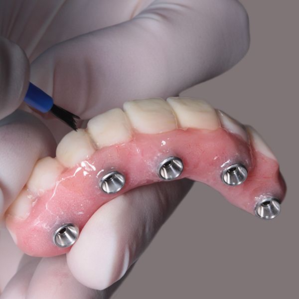 implant-supported denture