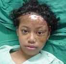 child having surgery