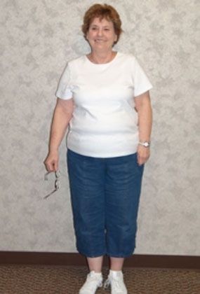 Dr. Matthew St. Laurent's overweight patient before gastric bypass