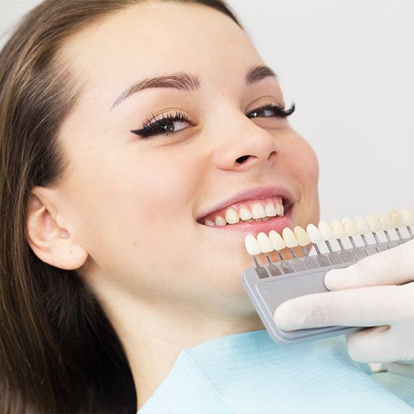 Veneer shade guide next to woman's smile