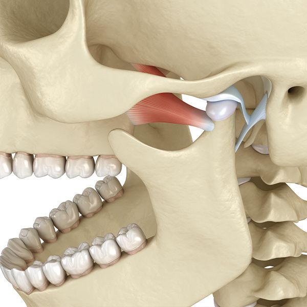 Inflamed temporomandibular joint