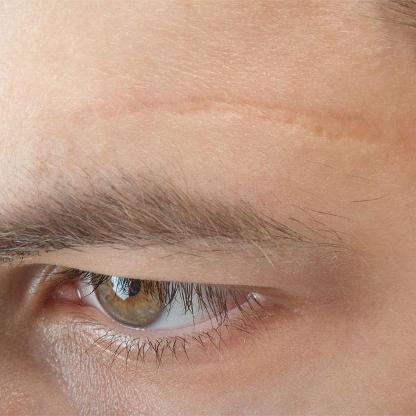 A man with a scar above his eyebrow