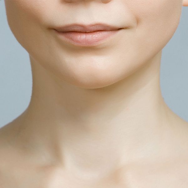 Neck Lift