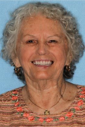 After full mouth rehabilitation