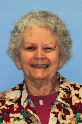 Before full mouth rehabilitation