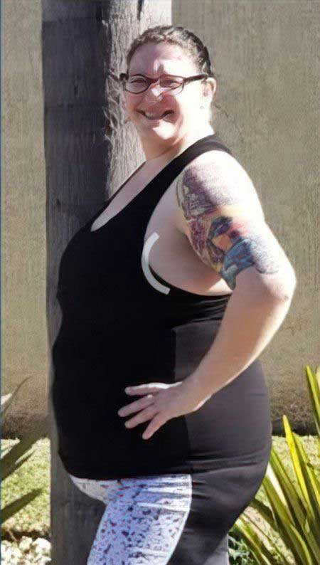 side view of overweight patient