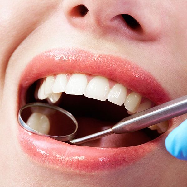 Dental mirror next to woman's tooth