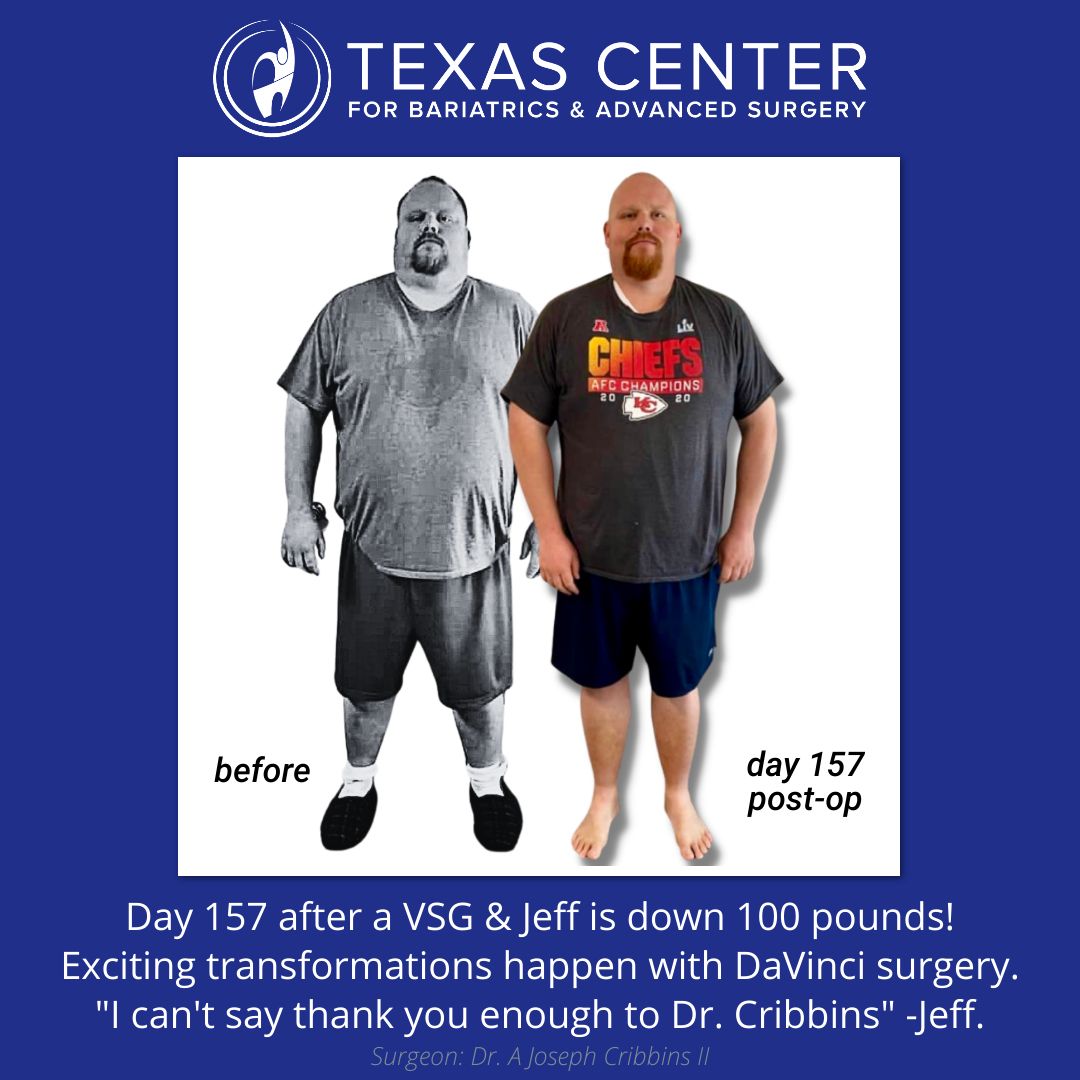 Weight Loss Surgery Texas Center for Bariatrics & Advanced Surgery