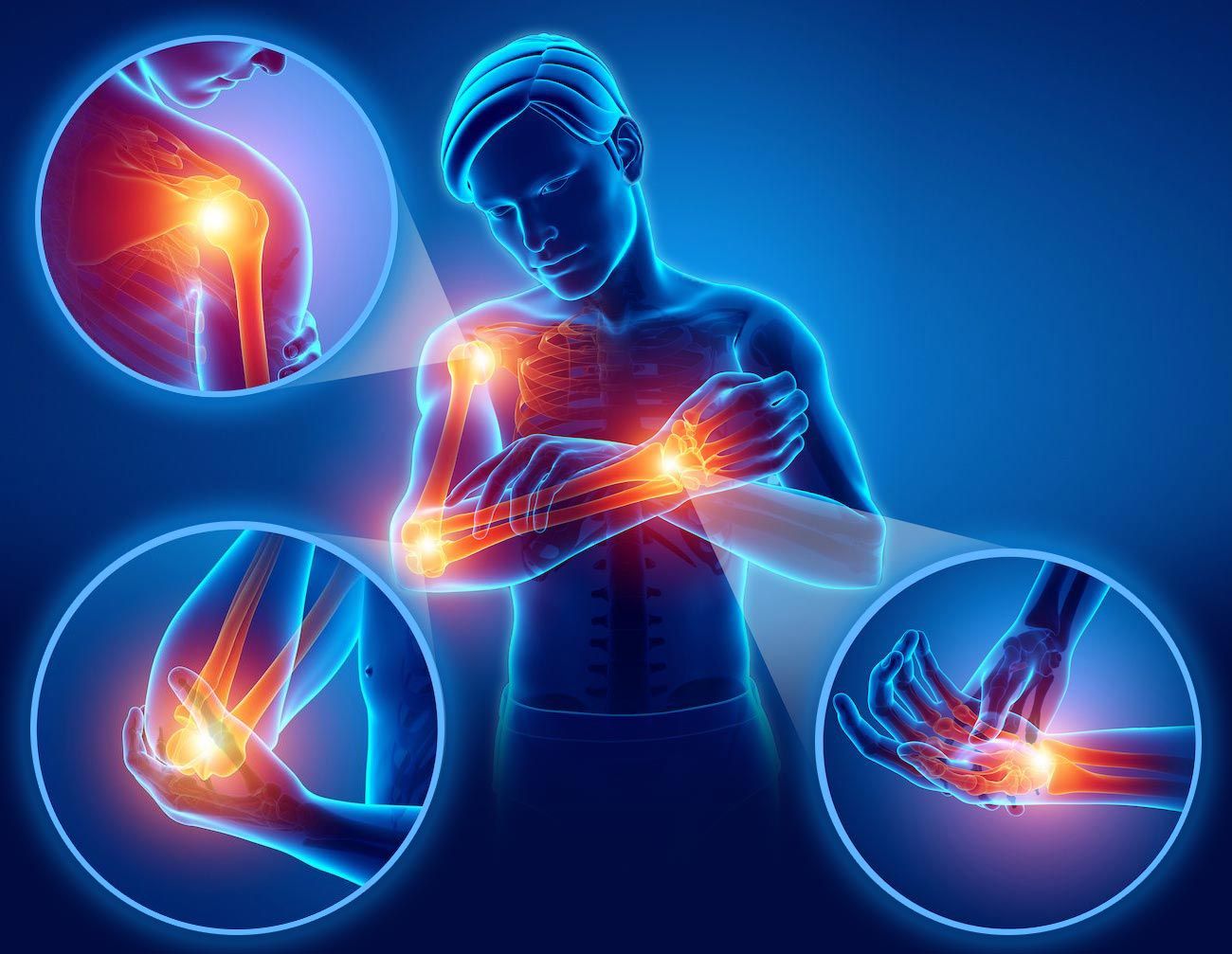 Illustration of shoulder, elbow, and wrist pain