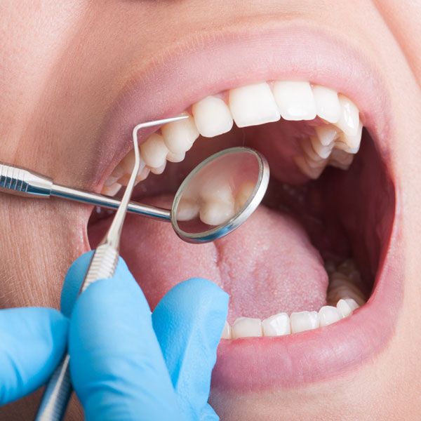 Dental Haus Germantown Dentist Nashville, TN