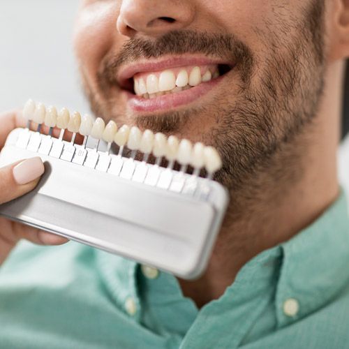 Shade-matching a patient's teeth