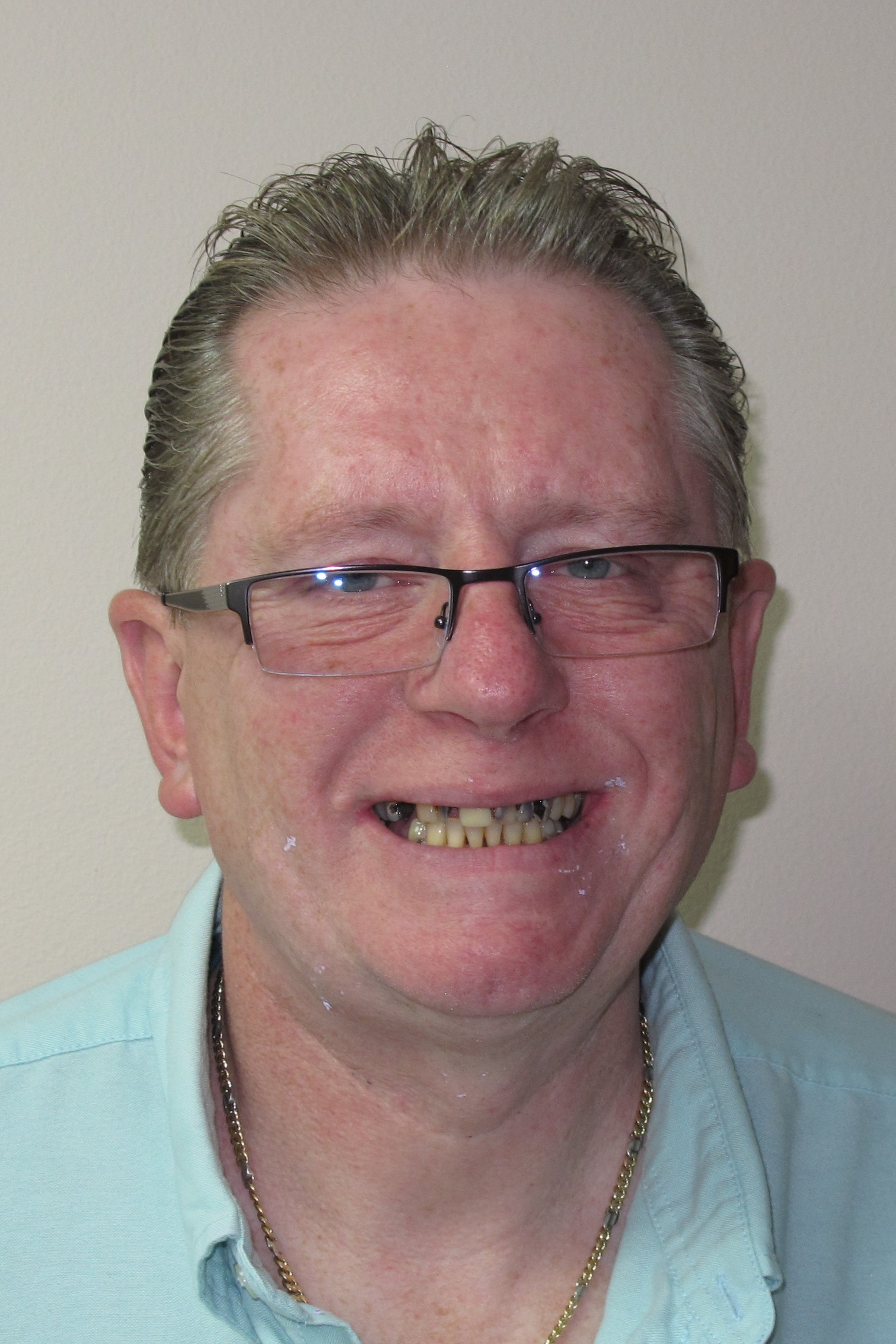 New Teeth from Dental Disaster Staten Island - Solid Teeth for Solid C...