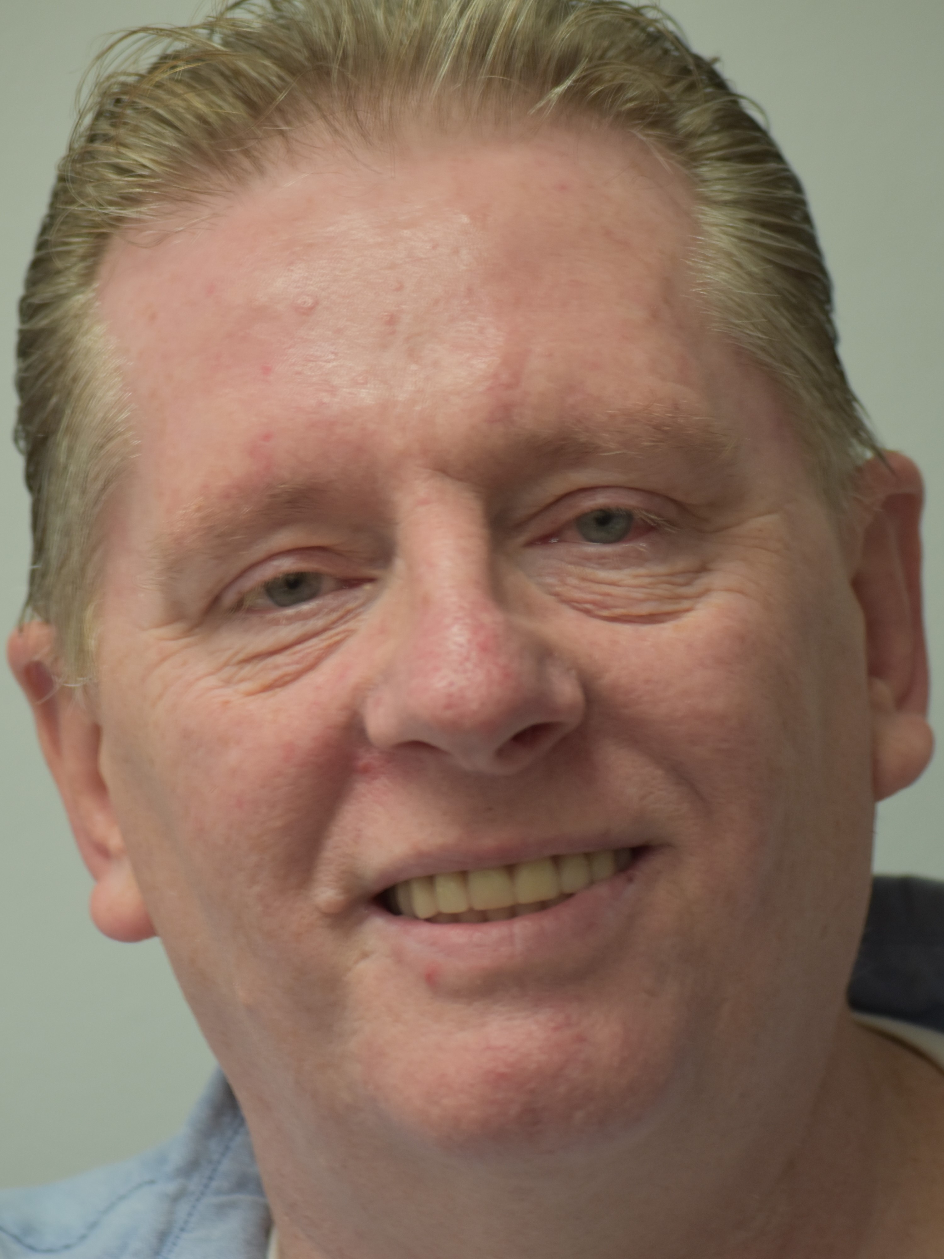 New Teeth from Dental Disaster Staten Island - Solid Teeth for Solid C...