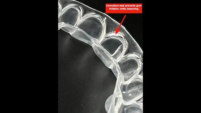 teeth whitening custom tray