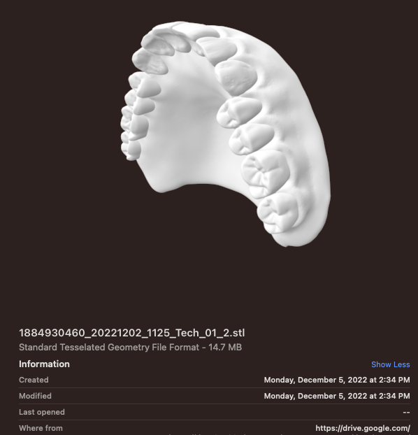 STL File of Digital Denture design mike meek Austin dentist