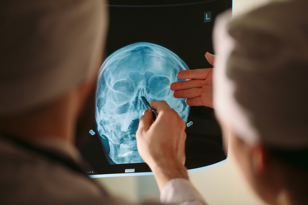 Doctors examining an X-ray of a person