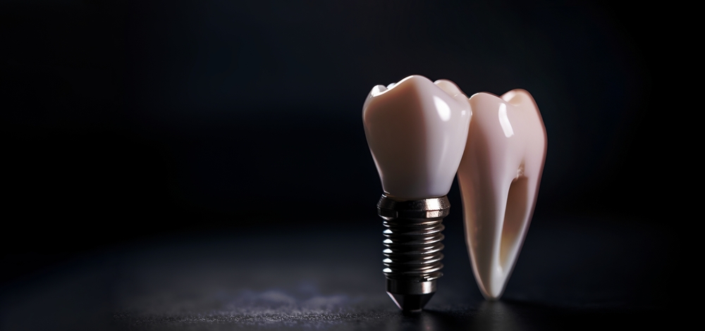 Model of an implant-supported dental crown next to a tooth