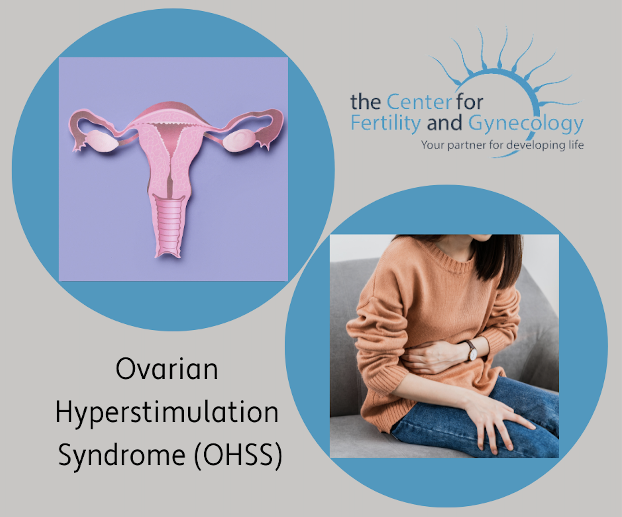 Illustration of the female reproductive system and photo of a women with stomach pain