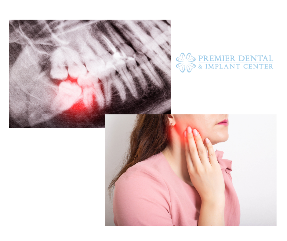 An x-ray and women with tooth pain