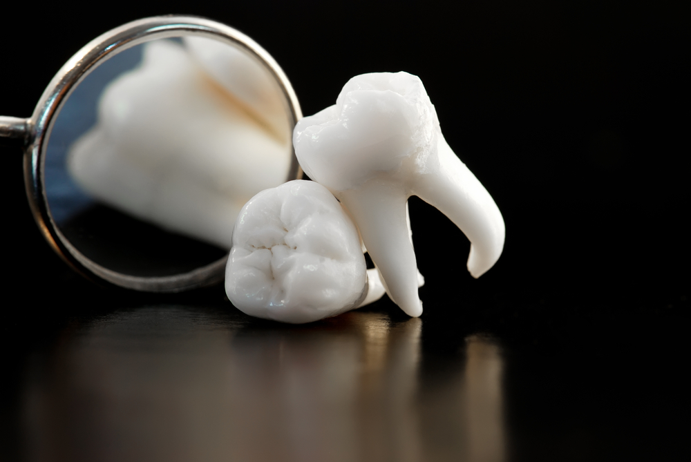 Model of wisdom teeth in front of a dental mirror