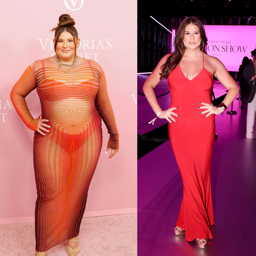 remi bader before and after weight loss surgery