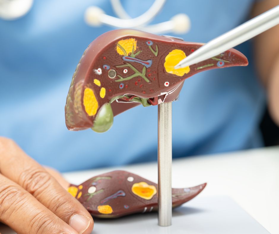 Gallstones of different sizes and colors