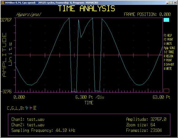 audio waveform overflow example shown in Hypersignal