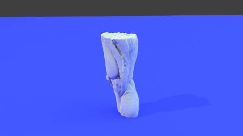 Muscles and ligaments of the knee in a 64 year old man - Extremity