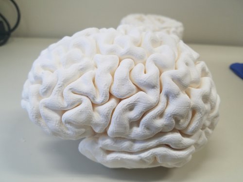 3D Printable Human Brain Model, STL format, from MRI - Brain - embodi3D.com