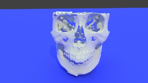 Ct Scan Stl File Processed Dental Orthodontic Maxillofacial Ct Scan Stl File Processed Dental Orthodontic Maxillofacial