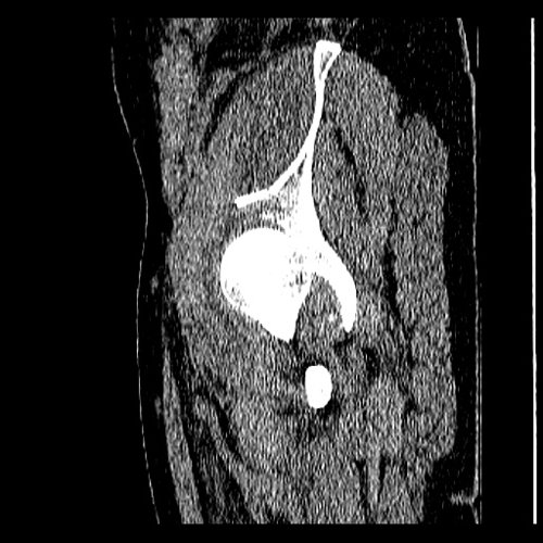 Pelvis 2 - Abdomen and Pelvis CTs - embodi3D.com