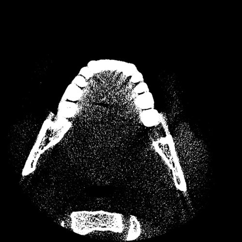 Ct scan jaws Dental, Orthodontic, Maxillofacial CTs