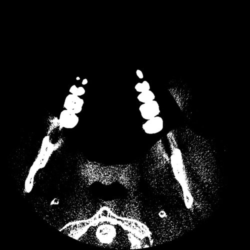 Ct scan jaws Dental, Orthodontic, Maxillofacial CTs